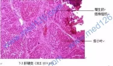 执业兽医考试"兽医病理学"辅导笔记